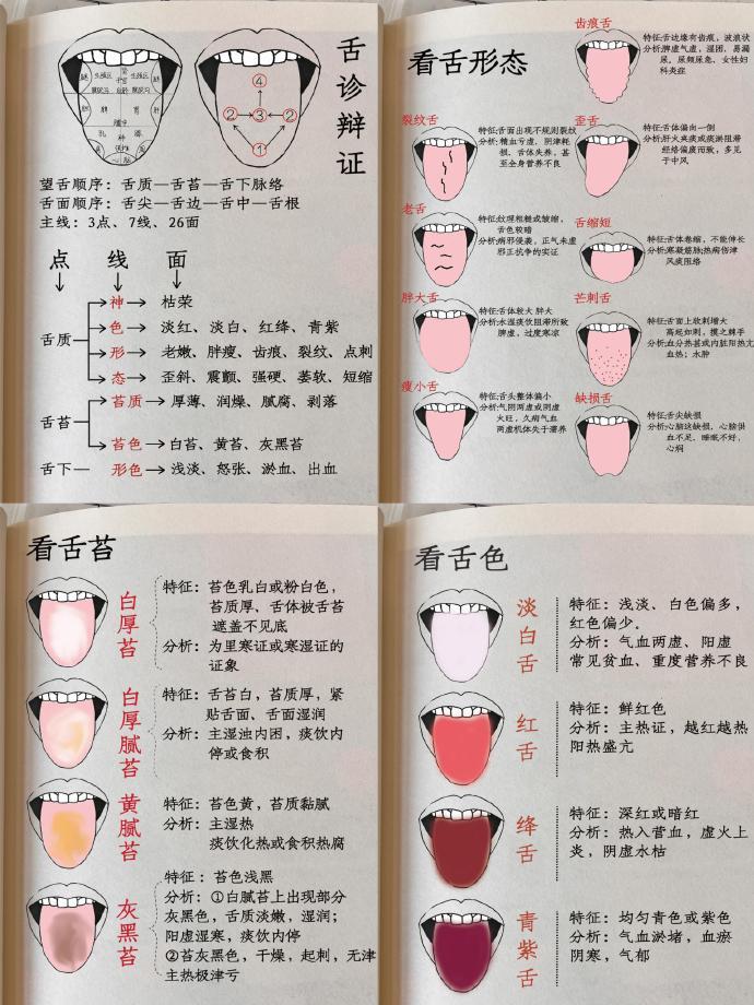 谁懂这几页纸的含金量！（舌诊万能公式） ​​​