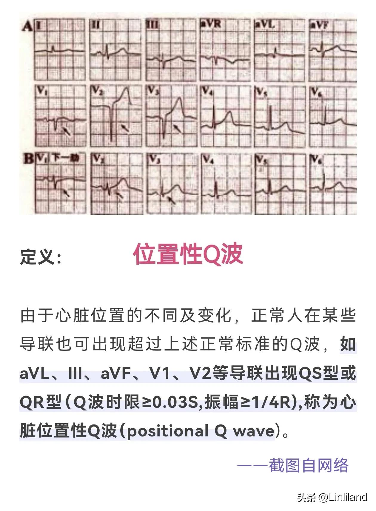 周三下午，月湖街老干局医院，一对母女拿着体检本前来咨询，女儿刚在诊桌前坐下，就递