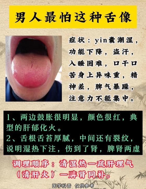 男人最怕这种舌象！