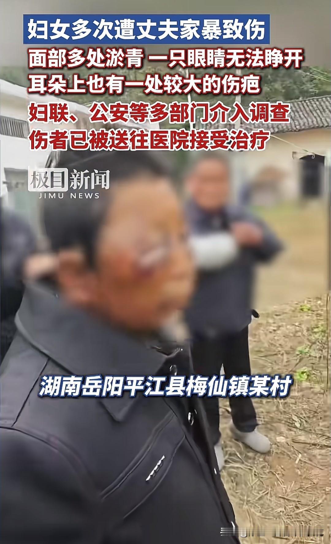 终于有新闻报道了！今天湖南岳阳一名妇女被家暴整的不成人样，受伤视频上传之后引发广