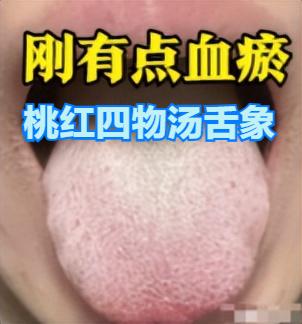 万病皆由堵！血瘀从轻到重的6个阶段，30秒教你如何调理！你是哪种情况？

一、 