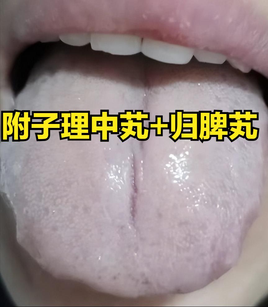 附子理中芄的四个经典搭配，一次解决99%的脾胃难题

1.附子理中芄+归脾芄——