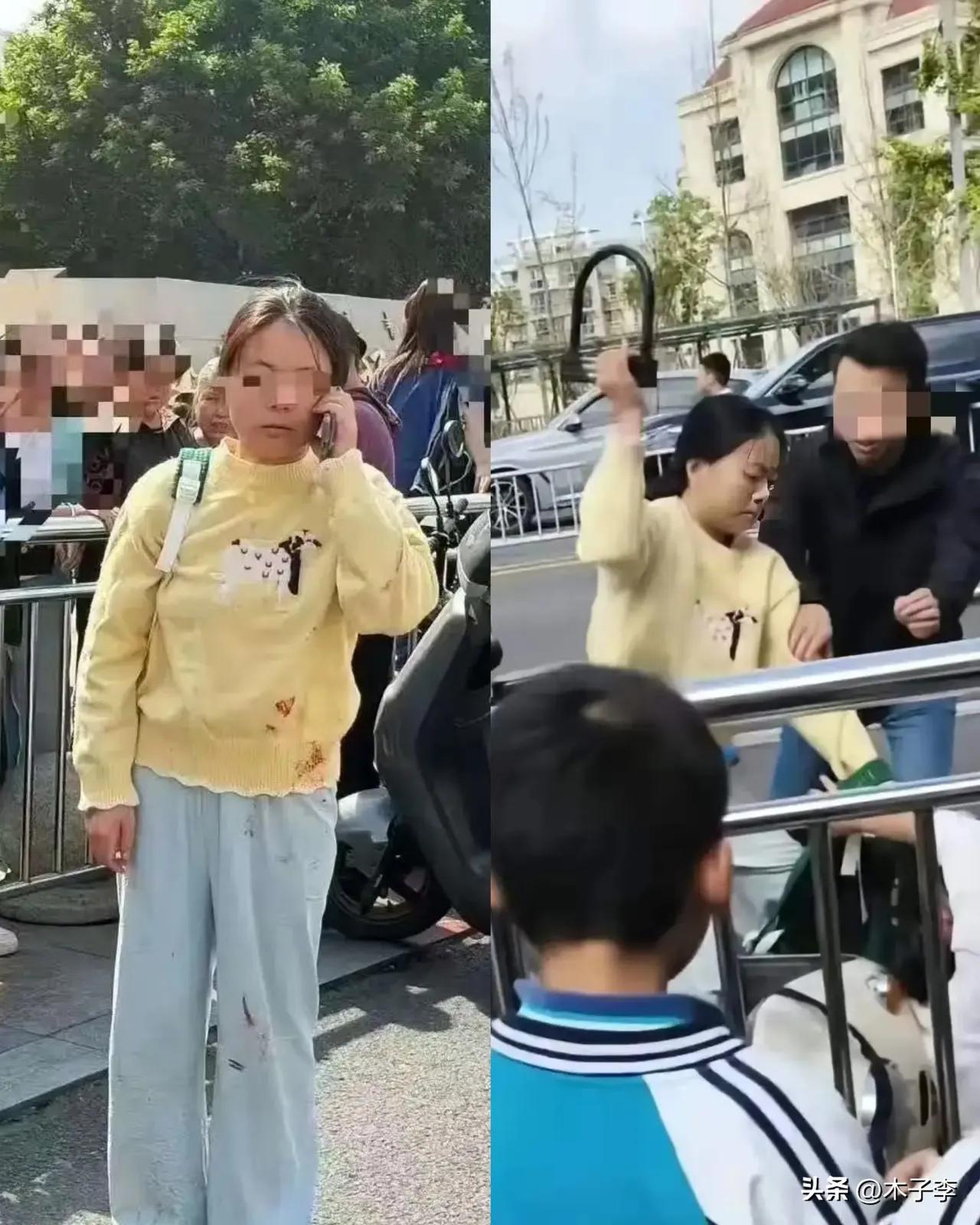 成都用U型锁打人的曹某某，接下来要面临以下几个窘境：
 
1. 被拘留，可能要进