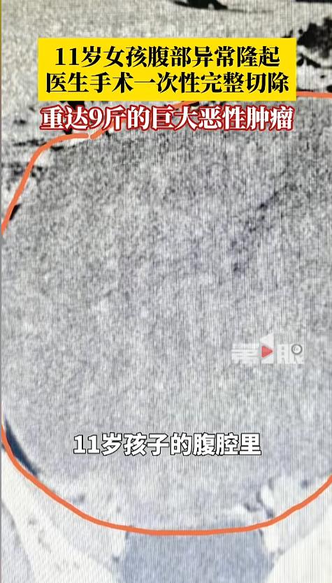 “万万没想到！”近日，一女孩被老师发现，腹部有一个异常的凸起，在老师的强烈建议下