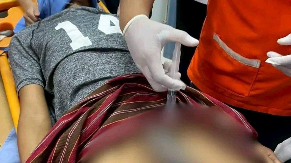 泰国这事儿真是让人惊掉下巴。泰国东北部武里南府有个男子，担心生殖器被盗，用不锈钢