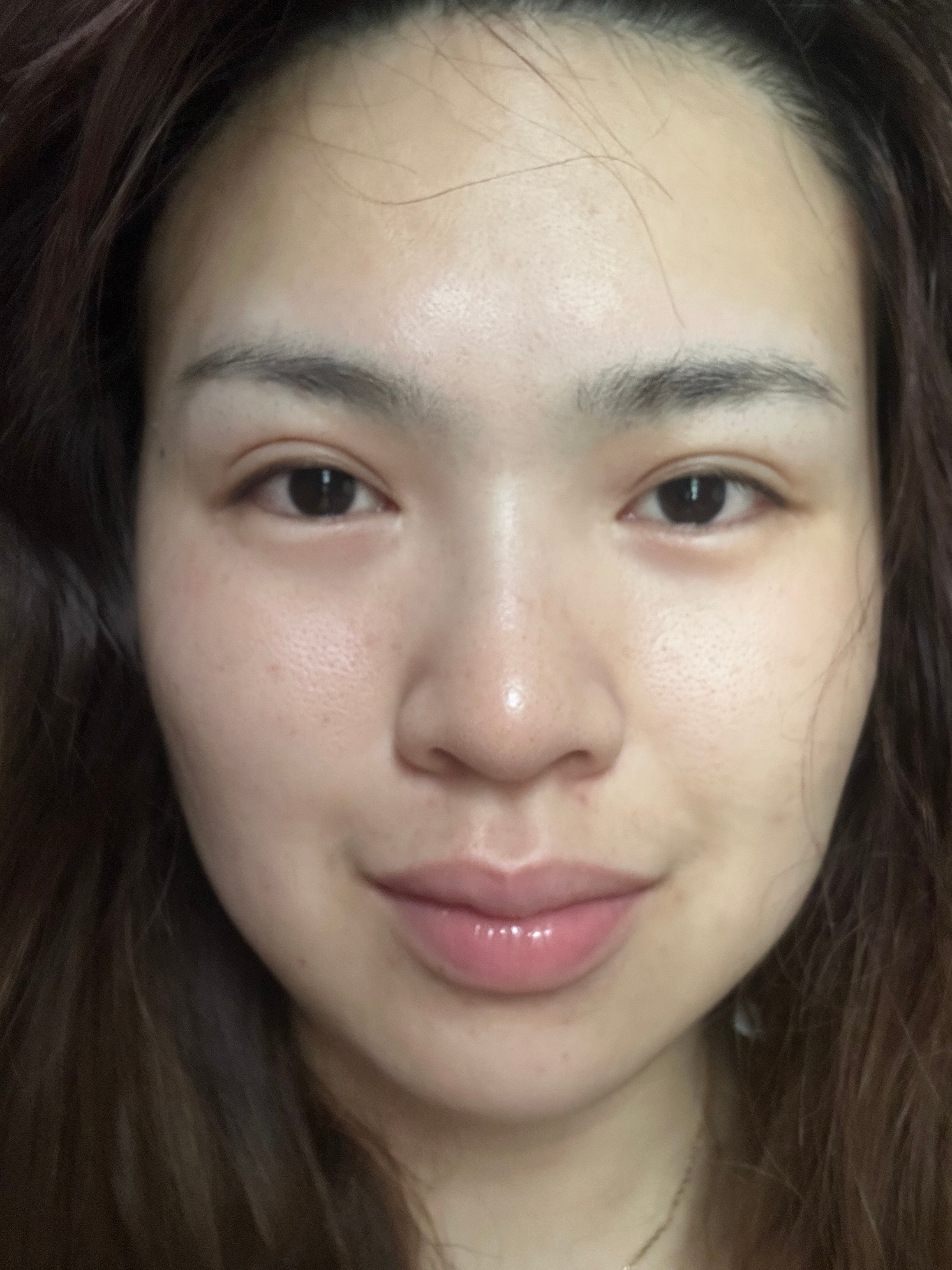 肿是我的命运 