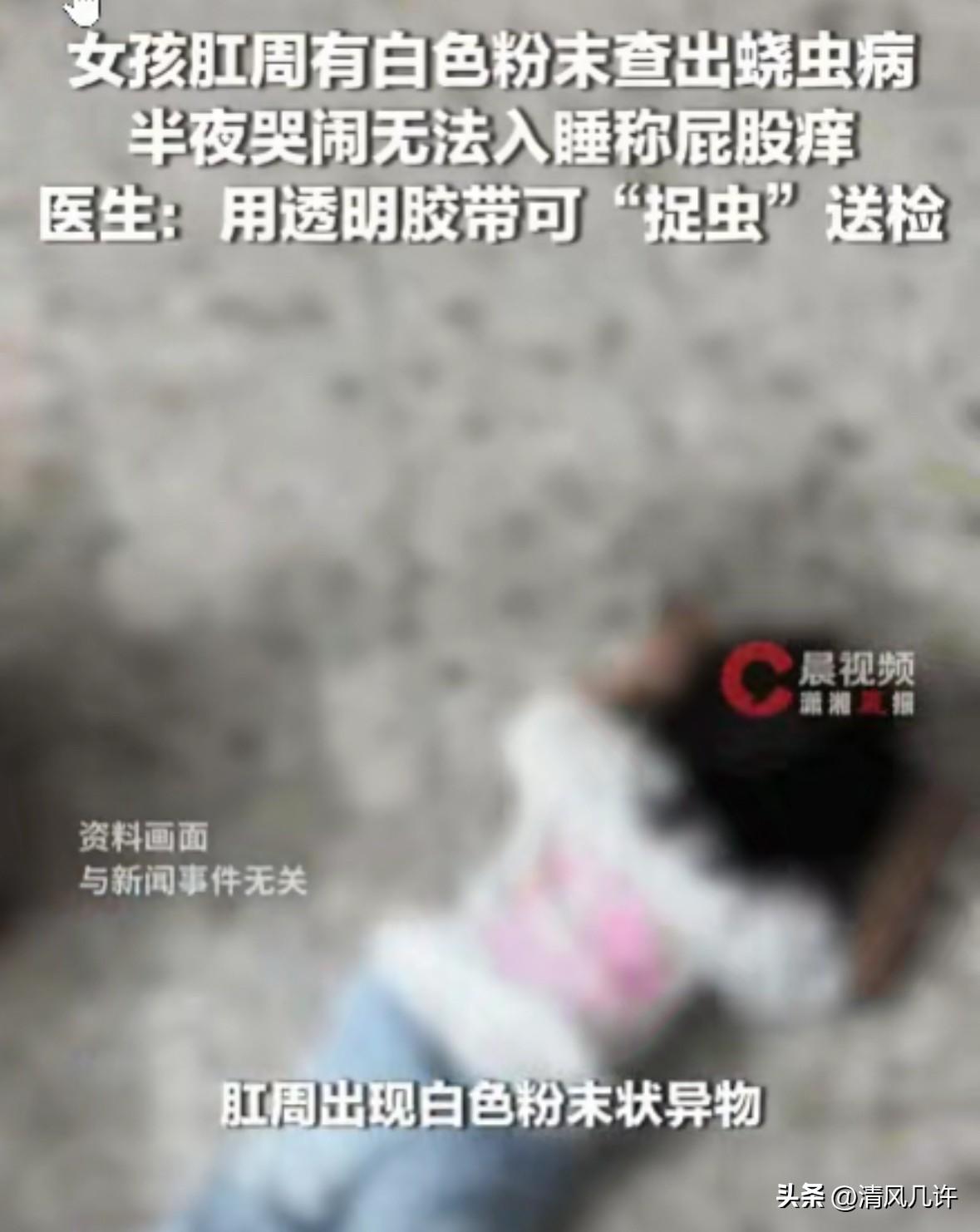 杭州，一位妈妈发现女儿天天半夜大哭，总说私处、屁股疼。一开始以为只是尿路感染，凑