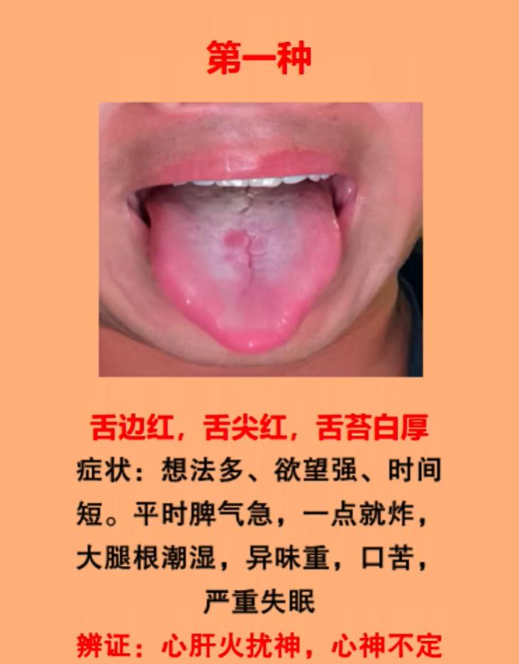 宗筋不振别盲目补肾！四种舌象，分清证型少走弯路