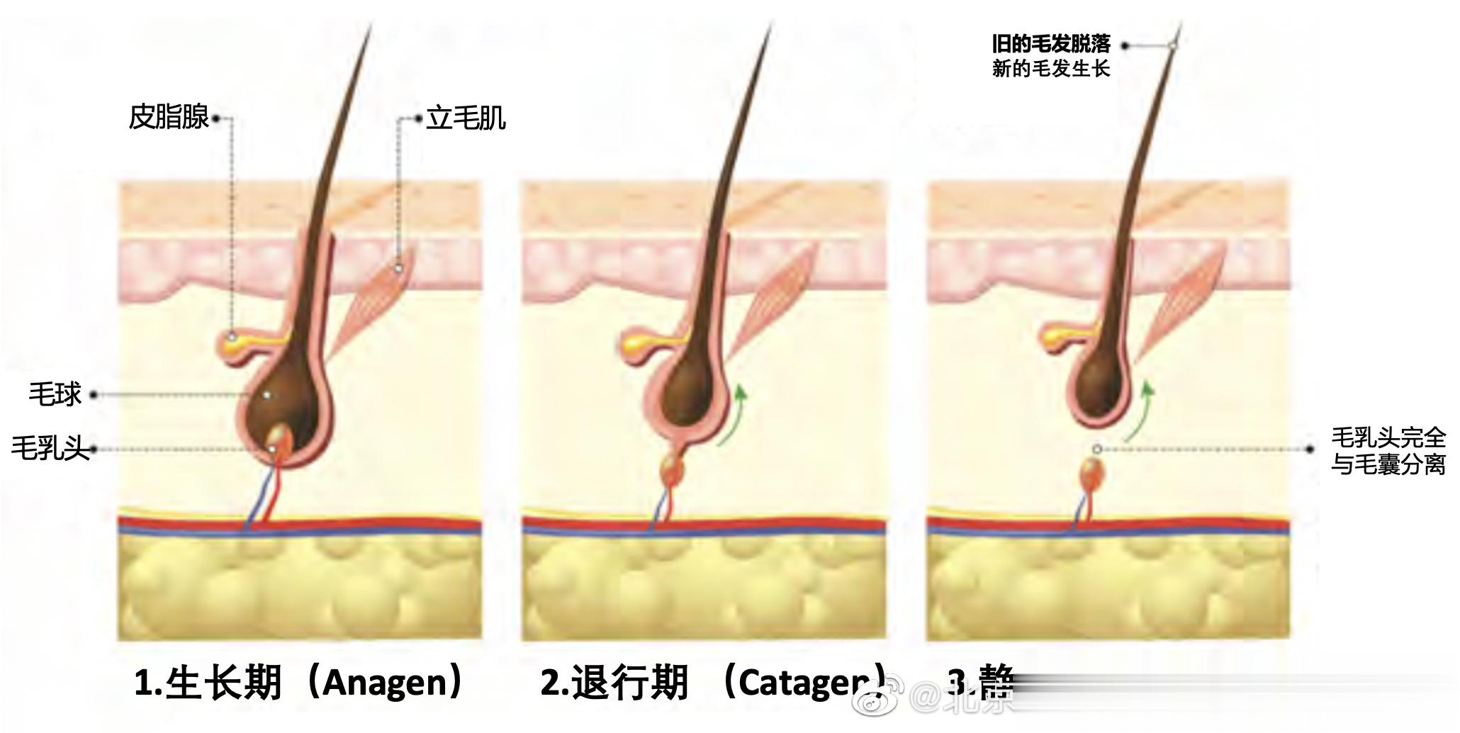 【多囊卵巢综合征会对脱毛效果有影响吗？】#微博医美菁英大赏##名医面对面# 多囊