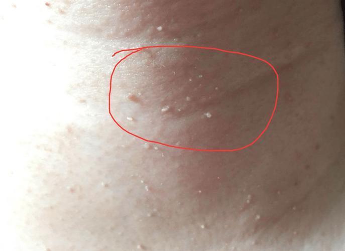 感染HPV，脸上会出现5个明显变化，医生不告诉你，但你自己要懂！

你留意过身体