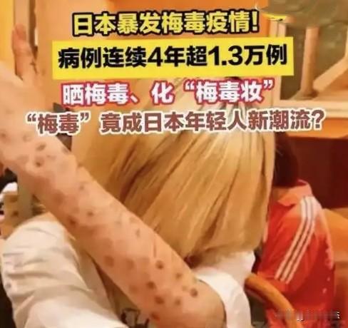 日本  梅毒  1.3万人确诊却面临“无药可治”？日本梅毒大爆发，背后的真相让人