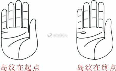 婚姻线出现岛纹情感易不利1、起点有岛纹，是开始是有障碍，后来穿破阻力，走到一起。