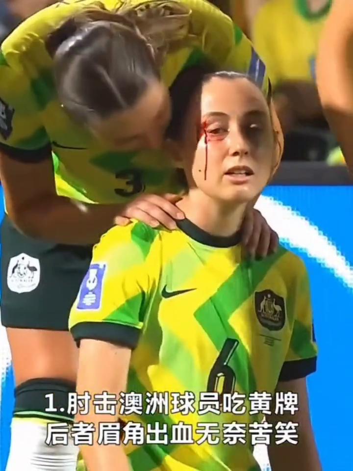 真狠，朝鲜女足肘击到澳大利亚球员吃黄，故意推倒门将被警告。
·1.肘击澳洲球员吃