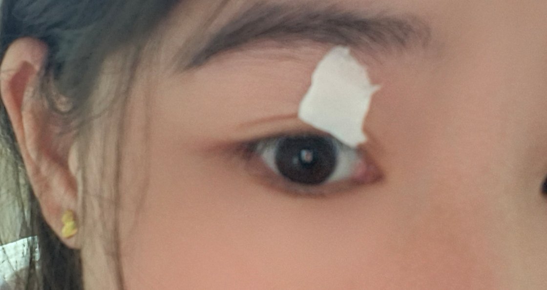 没办法了，跳的我太难受了，土法子治一治 