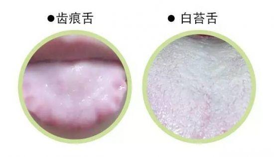 舌苔厚如雪，若是吃桂附理中丸无用，这三药合用效果翻倍！

看到白厚苔，大部分人都