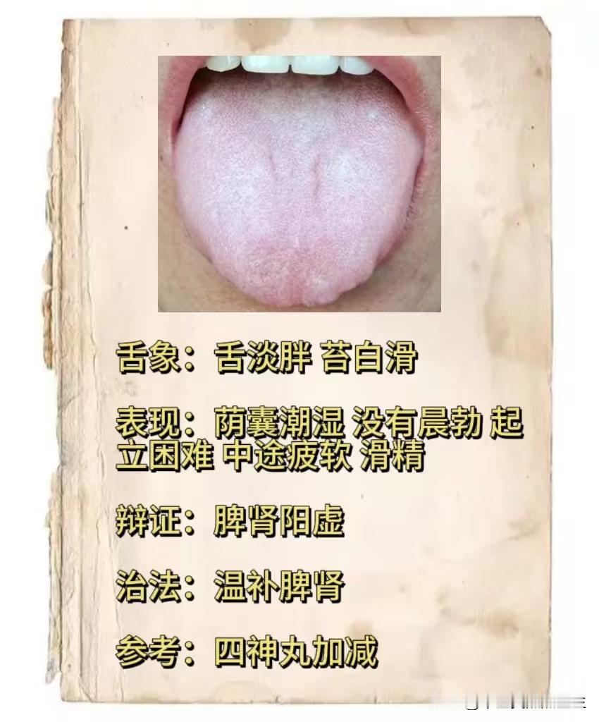 男性朋友总是关键时候不给力，中途疲软，时间短，还有滑精，中医给你辩证！
