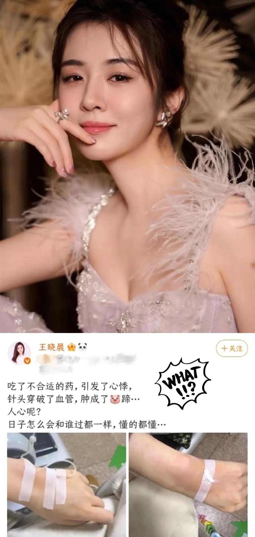 俞灏明这波，属实是真心喂了凉白开
 
俞灏明现在心里，估计别提多憋屈了。
王晓晨