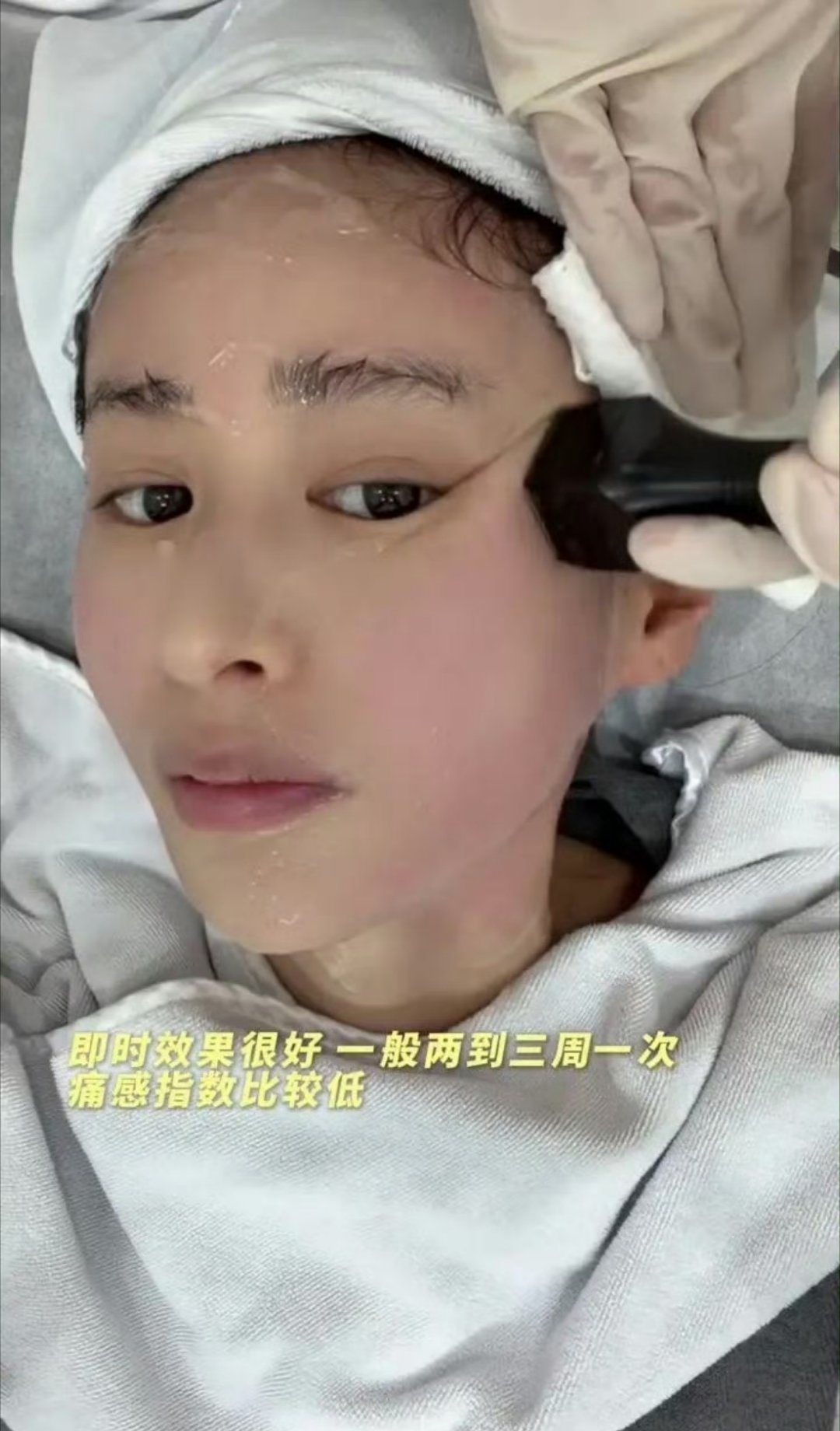 颖儿做眼部热玛吉疼哭了 不敢看第二遍太疼了 光是看着我的手心都出汗了