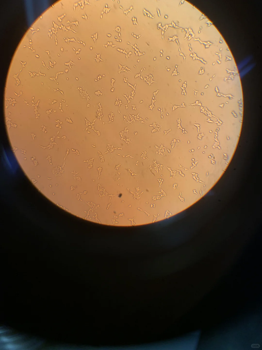 每个人的293细胞都是奇形怪状