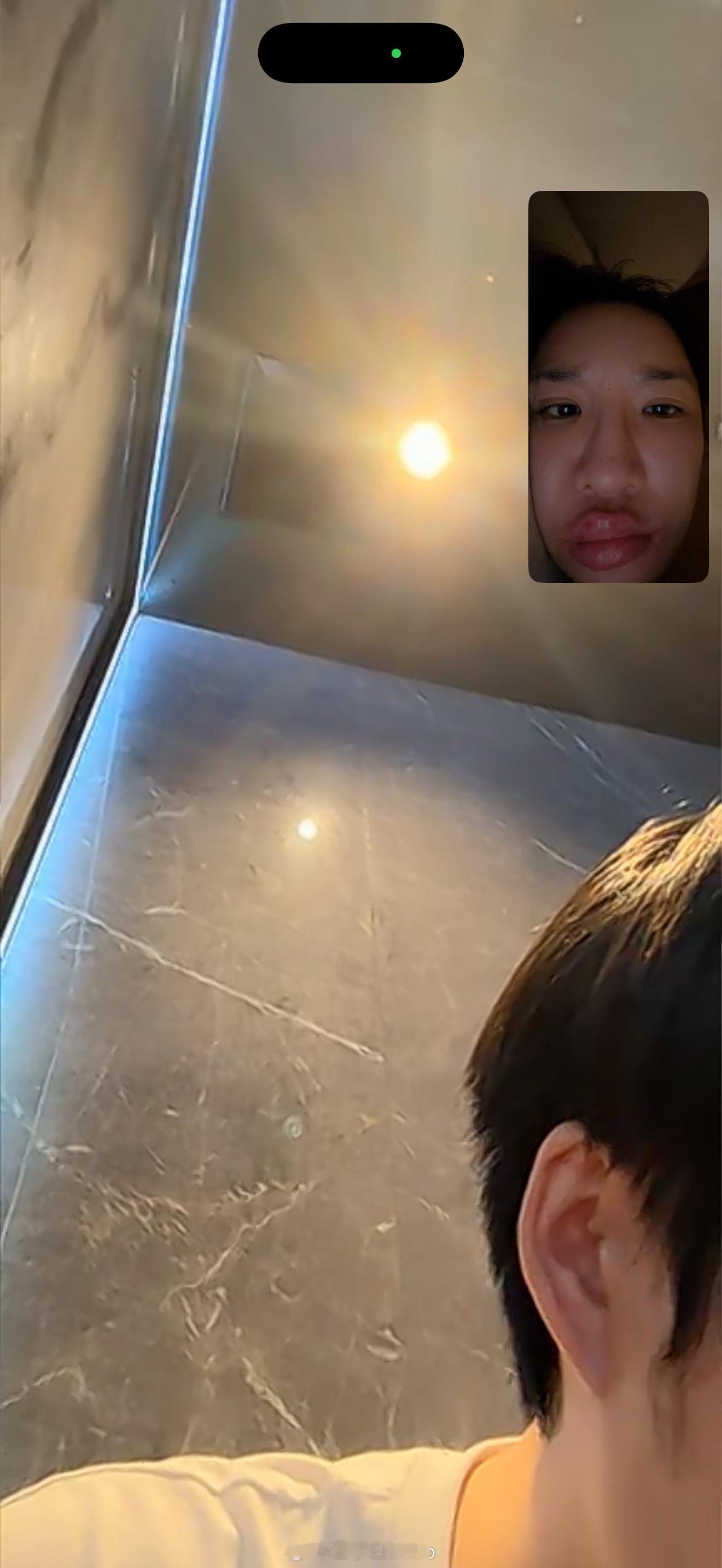 👄肿成这个样子了不敢和长辈吃端午节饭派管家一个人出门 他和我说他一出门就宿醉好