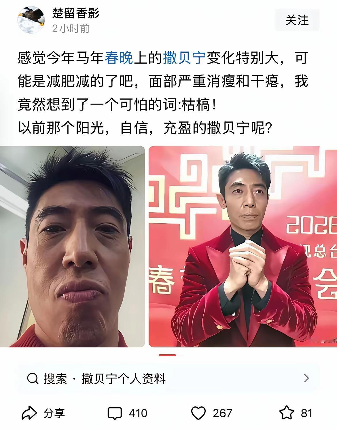 撒贝宁不知道是减肥还是身体不适，现在他的状态让许多他的粉丝颇为担心。
  减肥这