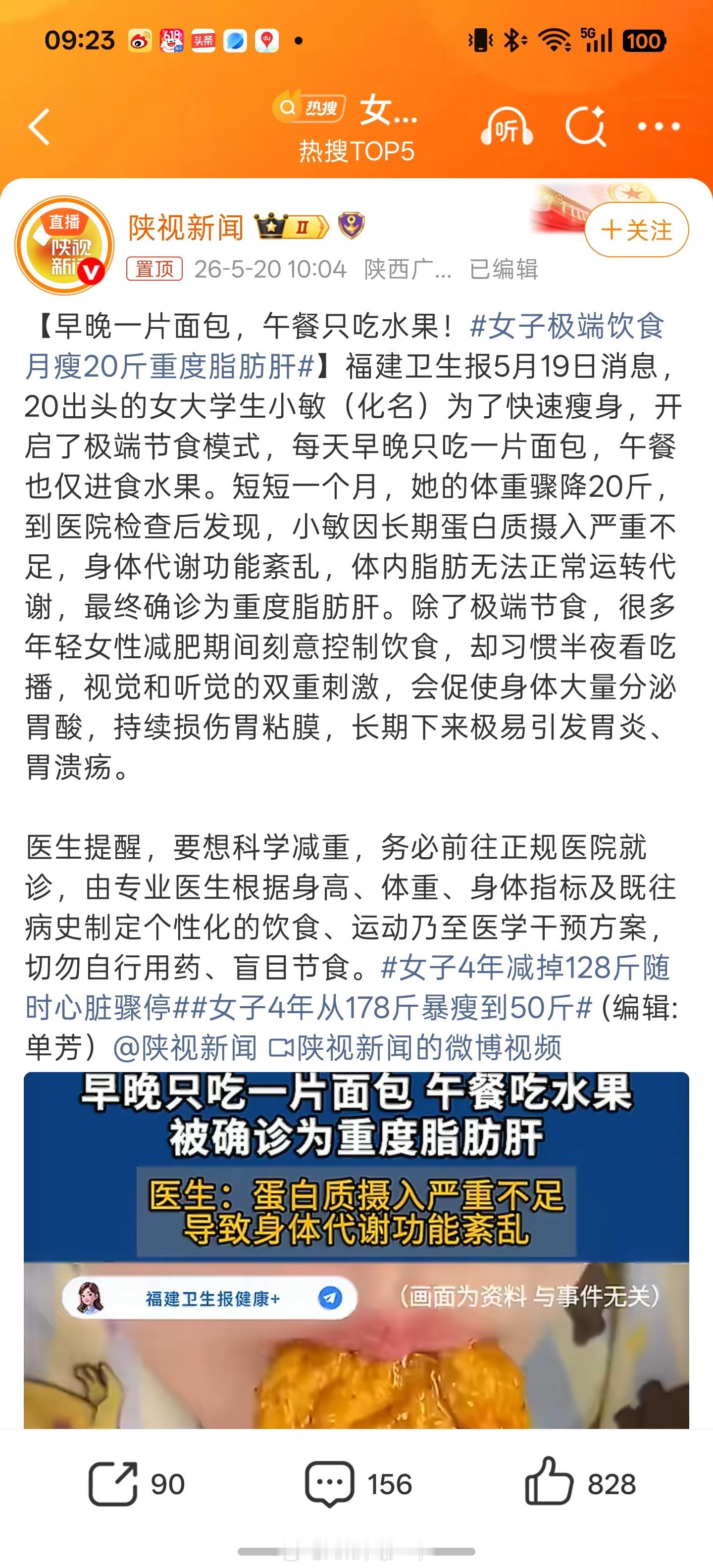 女子极端饮食月瘦20斤重度脂肪肝现在这些叫人减肥的路数都太野了，不吃药就各种不吃