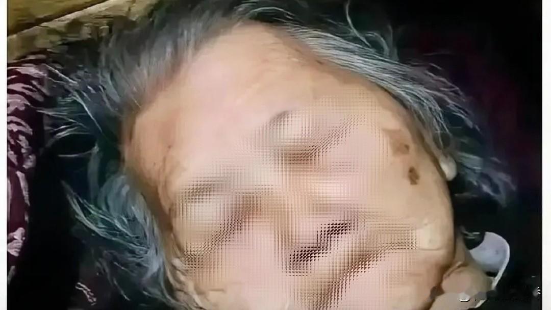 82岁老人
酒加头孢离世：
那句我拖累你们，不是客气是求救

82岁张奶奶趁家中