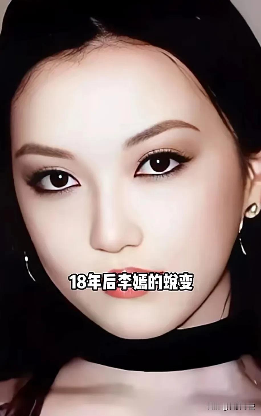 为何王菲坚持生下兔唇宝宝李嫣？明明产前检查知道有唇腭裂，但是王菲没有打胎，坚决生
