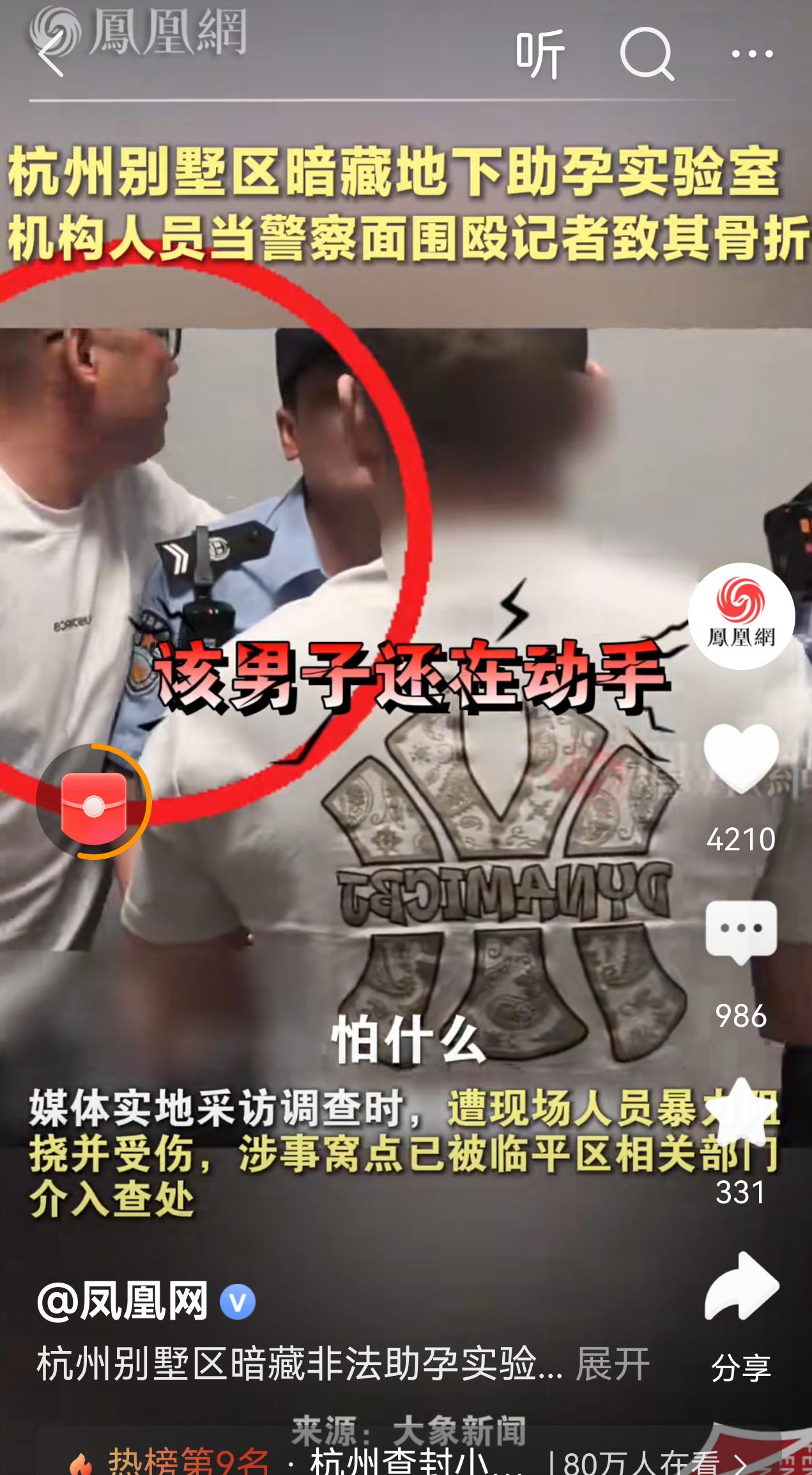 不敢想象！在警察在的时候居然还能把记者打骨折 ，真猖狂啊！
这下杭州的形象大打折