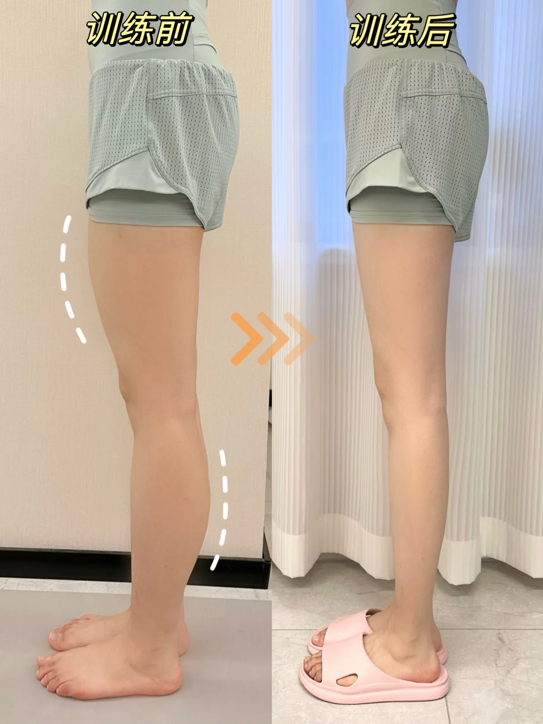 9命！五个动作改善肌肉腿绝了！瘦腿都去练
