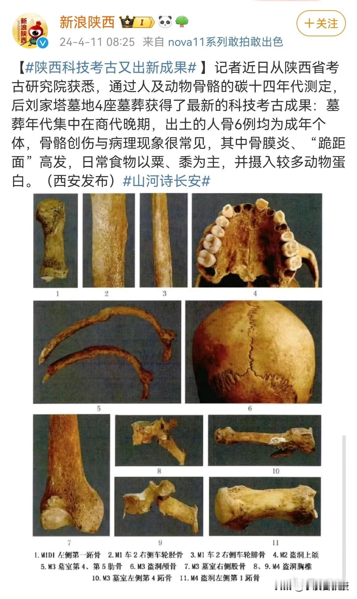 跪距面是长期跪坐姿态引起的，不仅跪坐，而且脚尖弯曲着地。