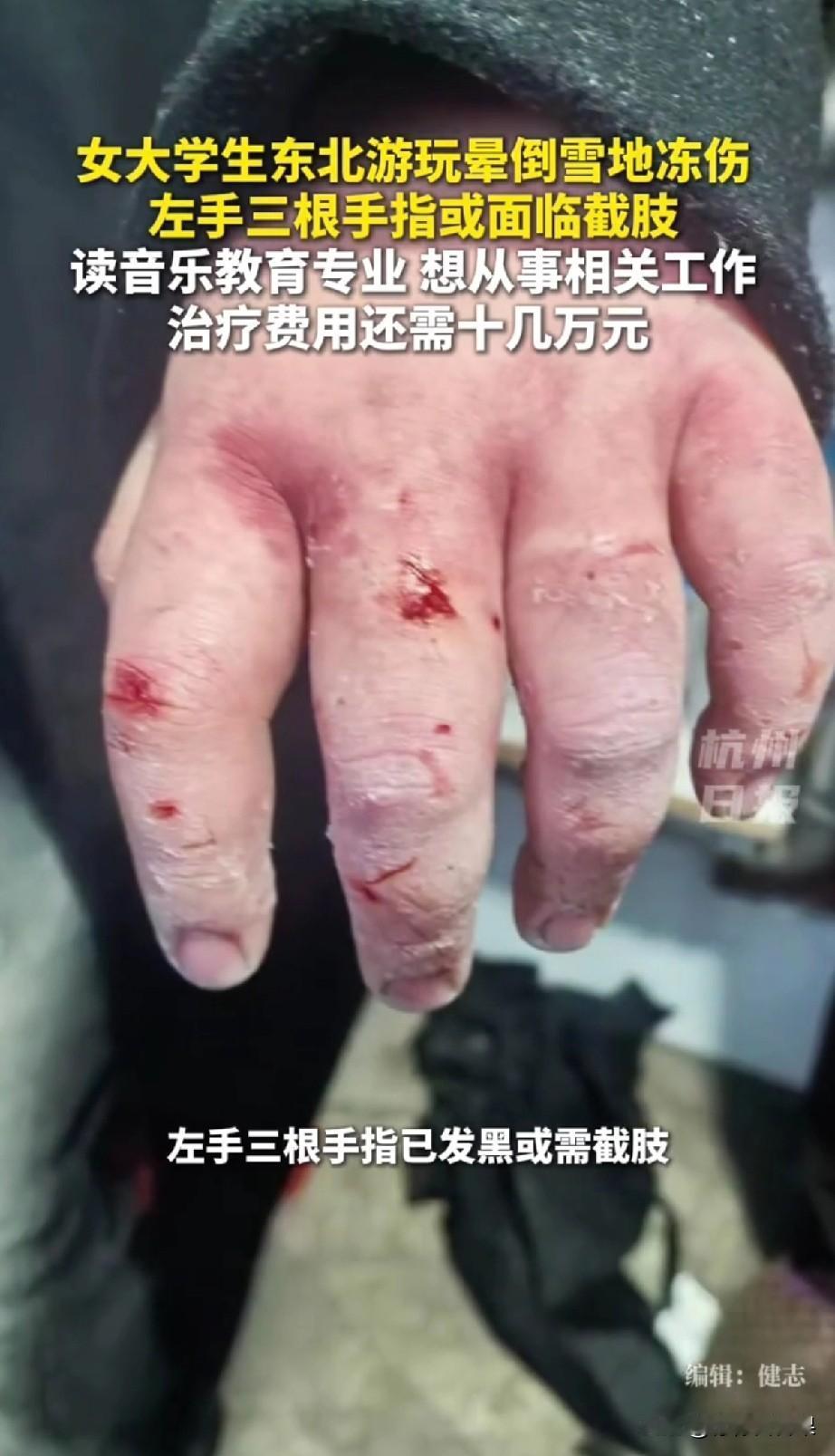 谁能想到，一场满心期待的东北雪旅，会变成一场噩梦。这个21岁的四川女大学生小陈，