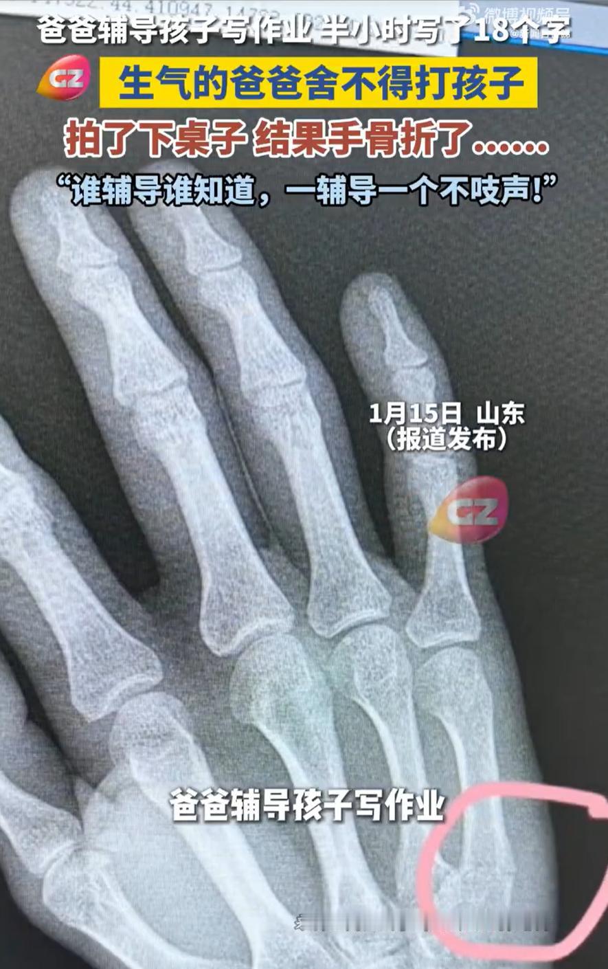 山东，一位父亲下班后在家里辅导孩子写作业，没想到，孩子30分钟下来就写了18个字