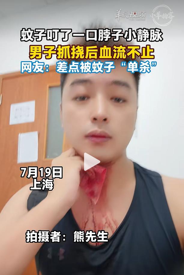 7 月 19 日晚间，上海市民熊先生遇上一桩惊险事，只是普通蚊子叮咬，抓挠后颈部