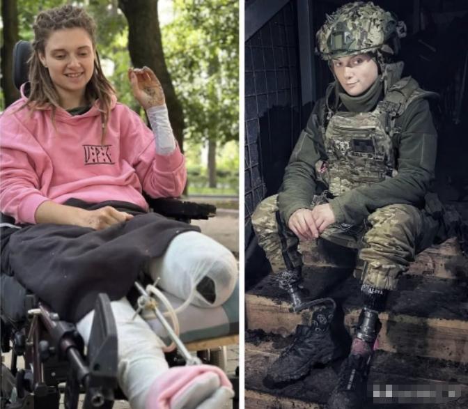 乌克兰女兵打成残疾，还要上战场！乌克兰美女士兵，双腿被炸断，经过13次手术还不能