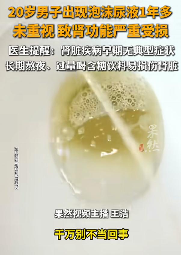“悲剧还是发生了”！江苏，一男子尿液出现泡沫一年多，但他没有重视，直到出现恶心呕