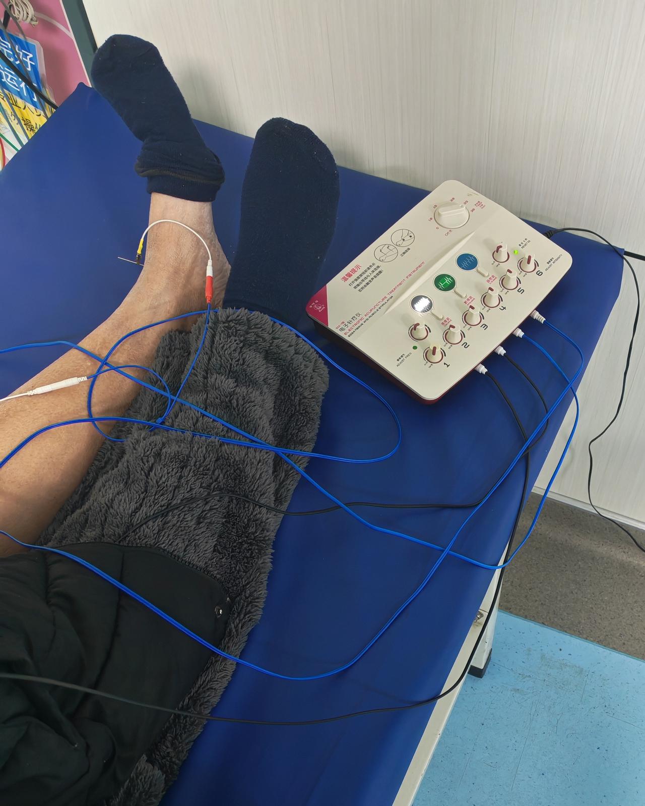 中医也是与时俱进在发展的。
最近父亲脑溢血住院做中医康复。
住院期间既不用输液也