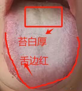 舌头黄成这样就连吃枣都上火，别说大补的补中益气芄了，你根本就不能用，别以为是补药