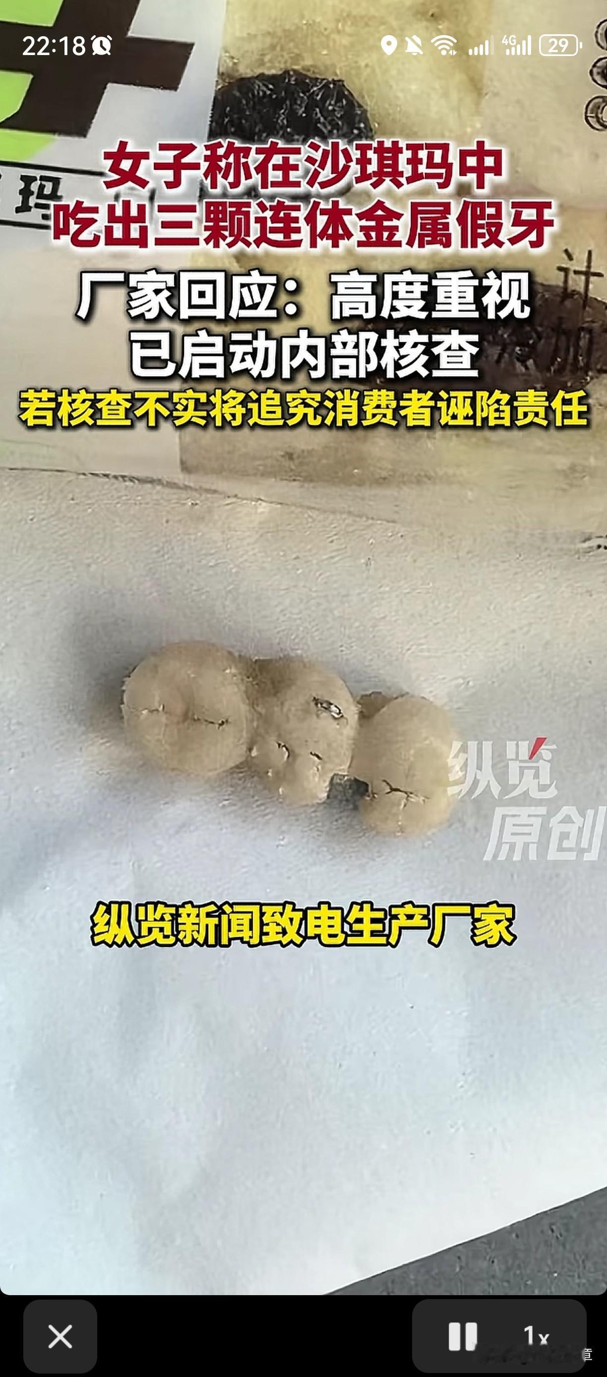 沙琪玛里吃出三颗连体假牙？
 
吃个几块钱的沙琪玛，居然咬出三颗连在一起的金属假