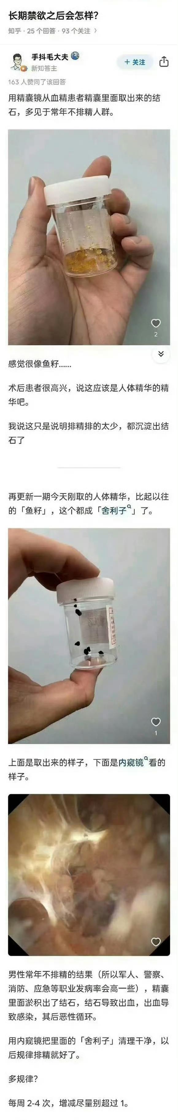 舍利子是不是就这样形成的？