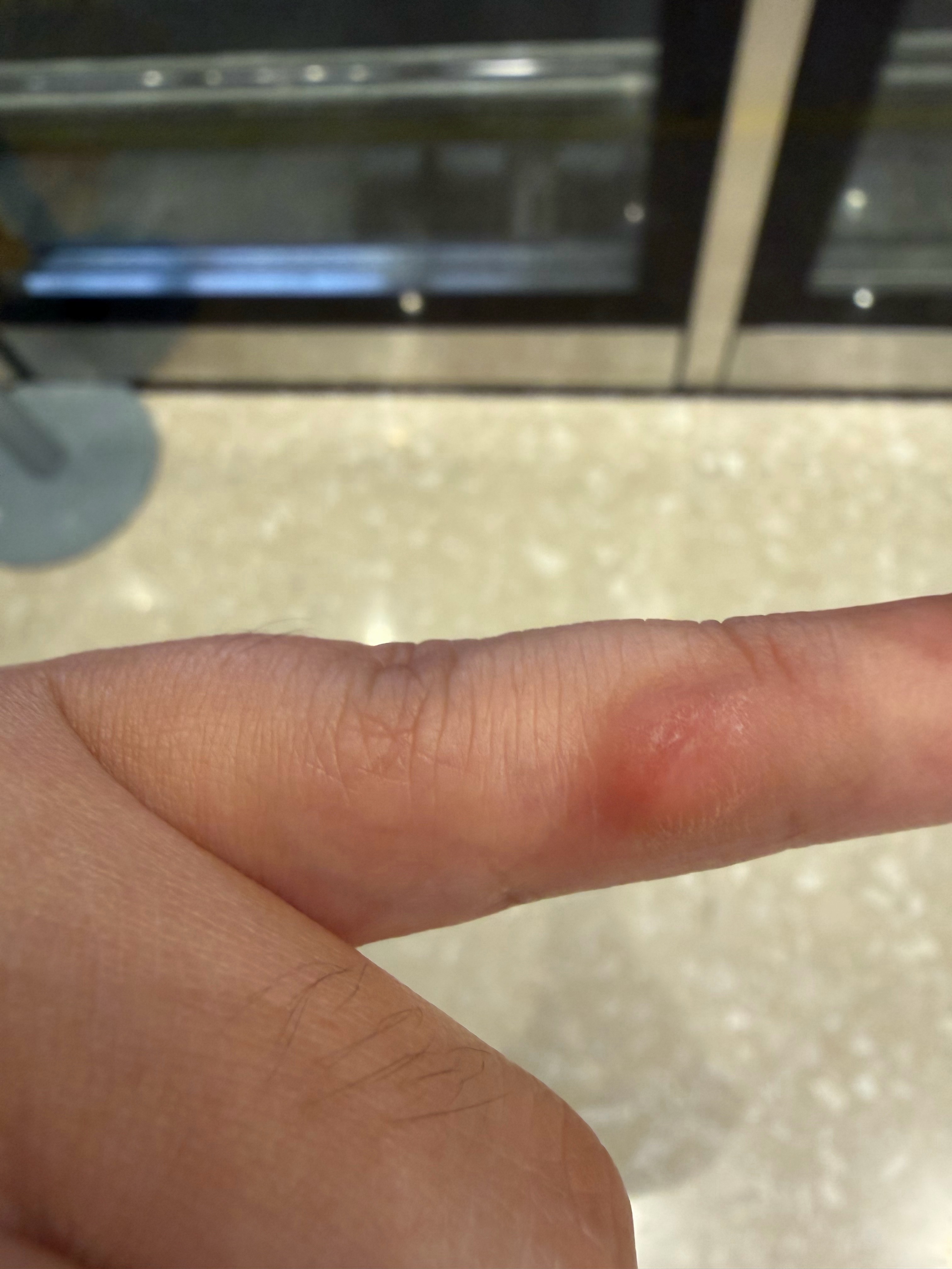 用iPhone前vs用iPhone后最大的区别就是小拇指的茧子，这破玩意太沉了，