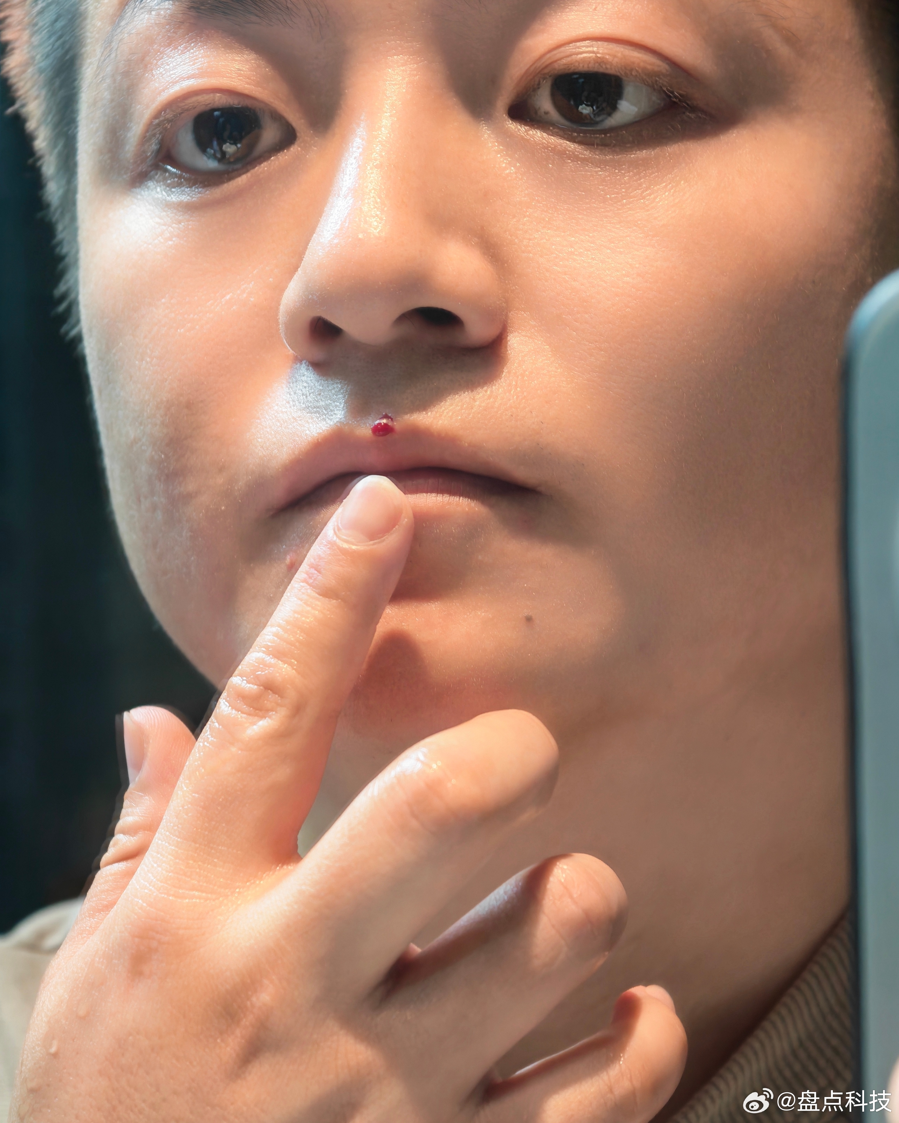 一不小心让自己闭嘴了用酒店的那种刮胡刀，还是要注意！！一不留神，就刮破了人中