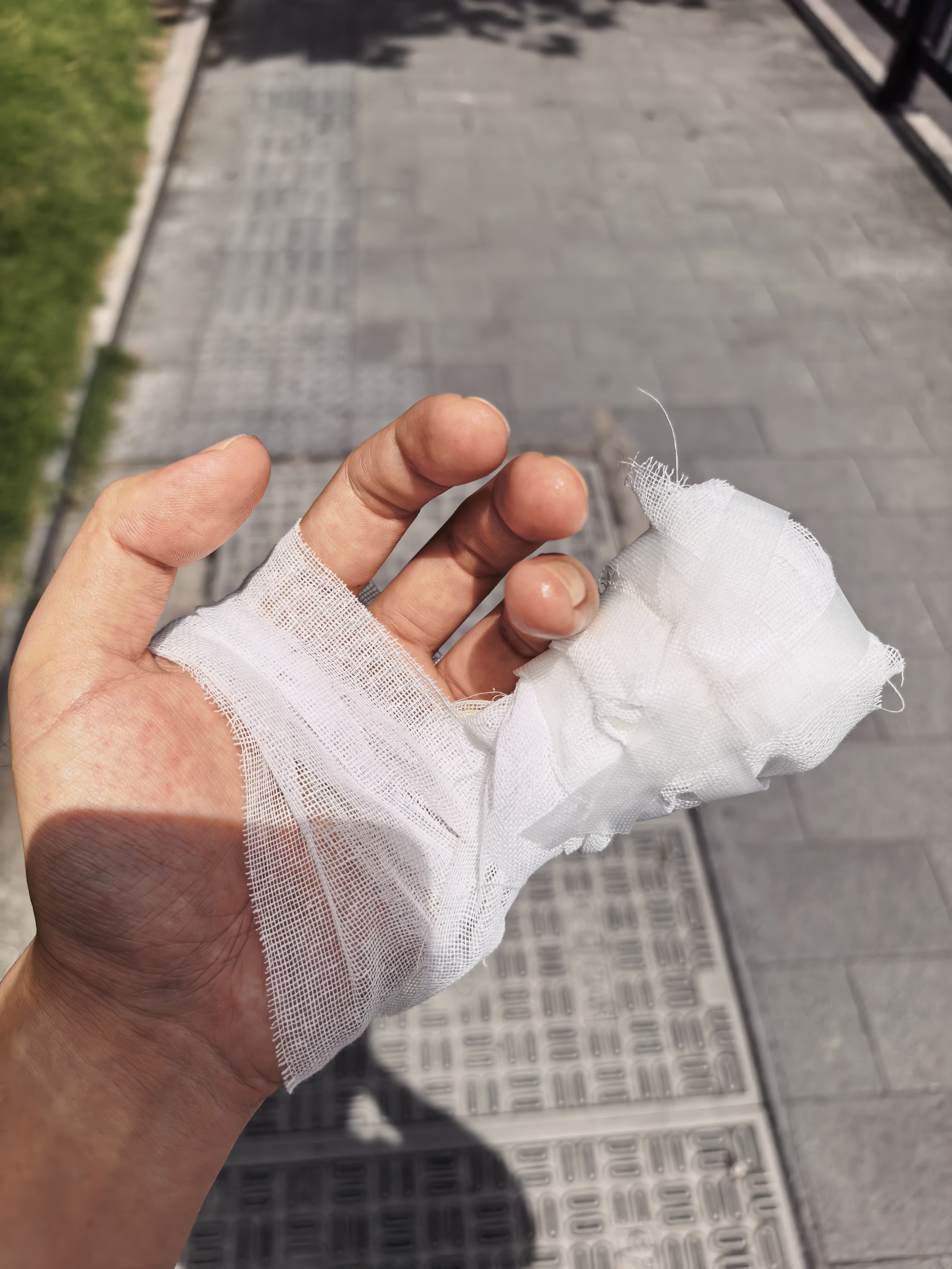 顺利出院～定期做检查就OK啦[捂嘴哭]日常数码研习社[超话] ​​​