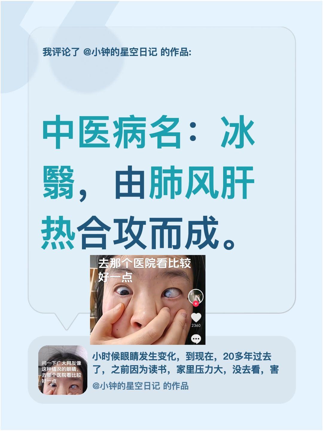 我评论了@小钟的星空日记 的作品：
中医病名：冰翳，由肺风肝热合攻而成。中医疾病