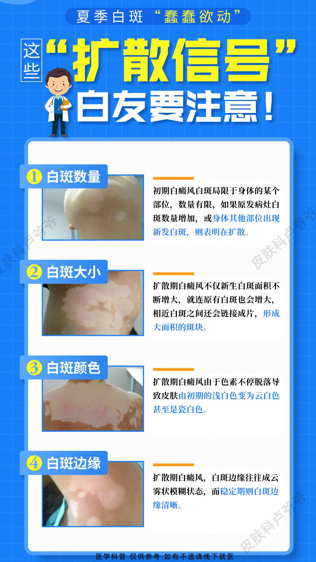 白癜风 医学科普 白斑 安徽