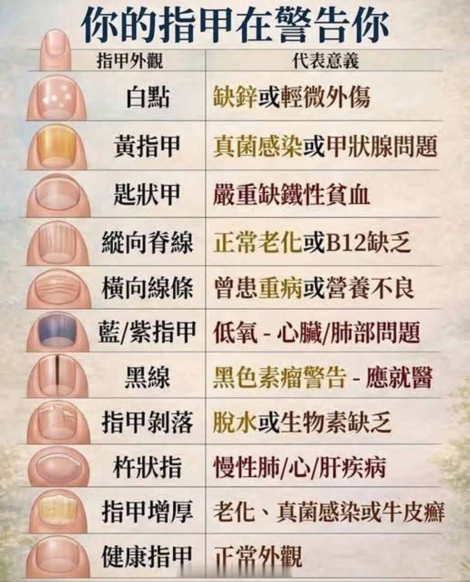 黄仁勋指甲网友们真是火眼金睛，连黄仁勋吃炸酱面时的指甲颜色都注意到了。不过问过阿