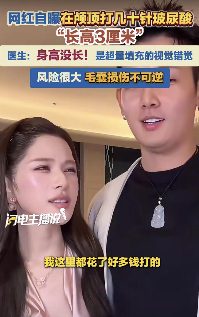 命真大！网红梅尼耶妻子直播自曝，为了长高在颅顶打十几针玻尿酸，身高从160cm变