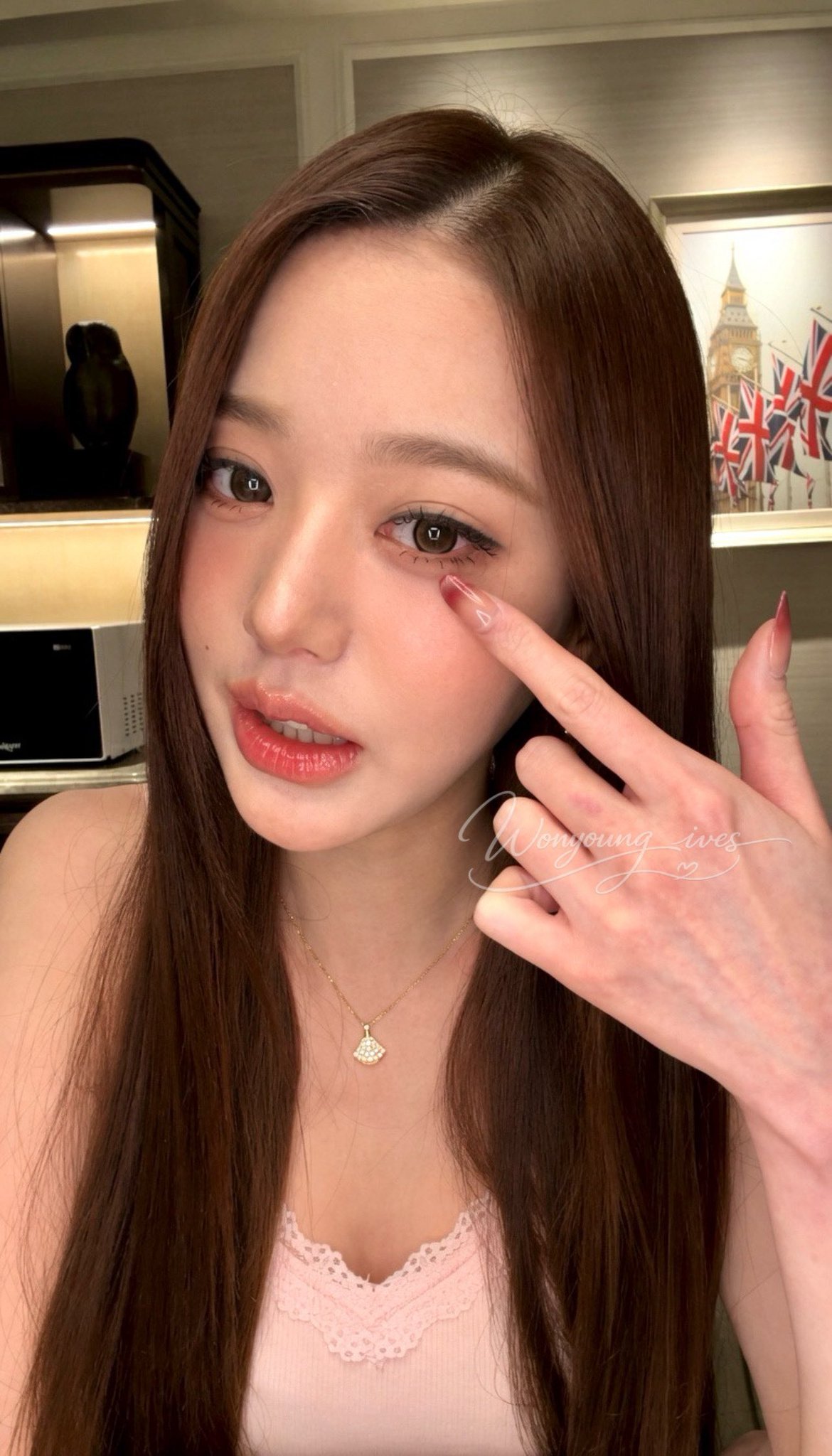 老乱手上的口子真的太深了 到现在都还能看到印子我的兰博基尼 