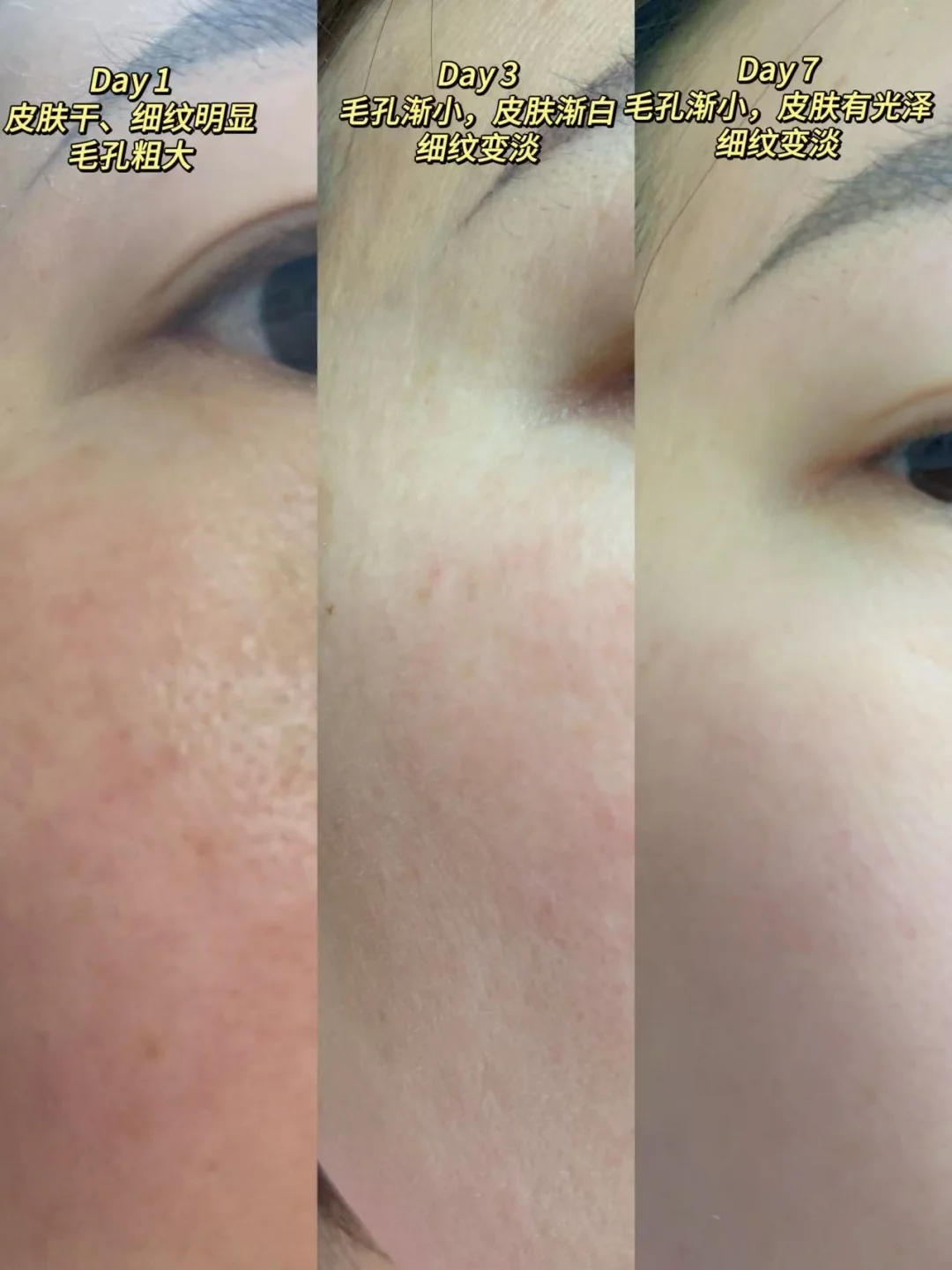 40+未婚是如何抗老淡纹的