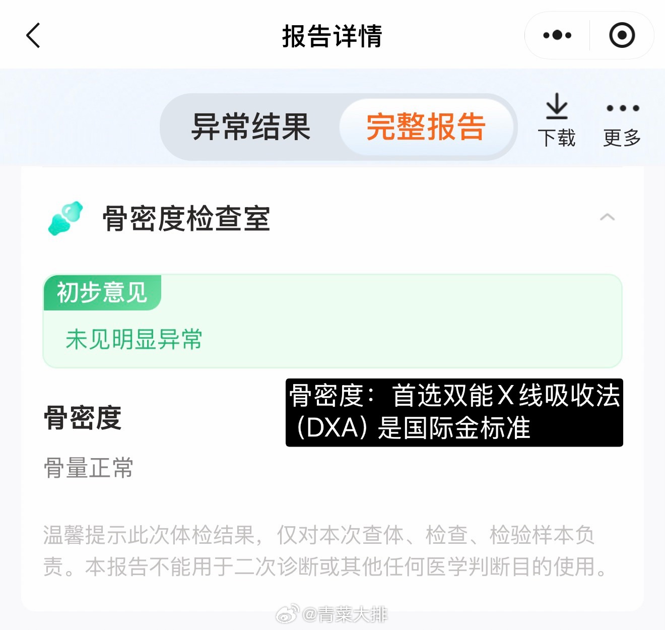 看我IP！昨晚喝了一条液体氨糖钙，酸奶味儿˶> ᴗ <˶如果你要补钙维D，试试我